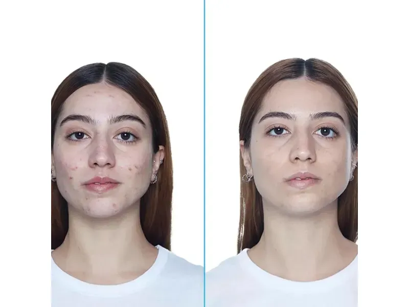 000000000075296703-UN-05